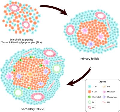 Tertiary Lymphatic Structures in Primary Hepatic Carcinoma: Controversy Cannot Overshadow Hope